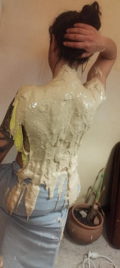 Prise d'empreinte avec alginate hypoallergénique